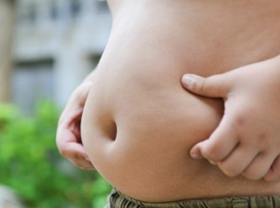 Obesidad Infantil y del adolescente 